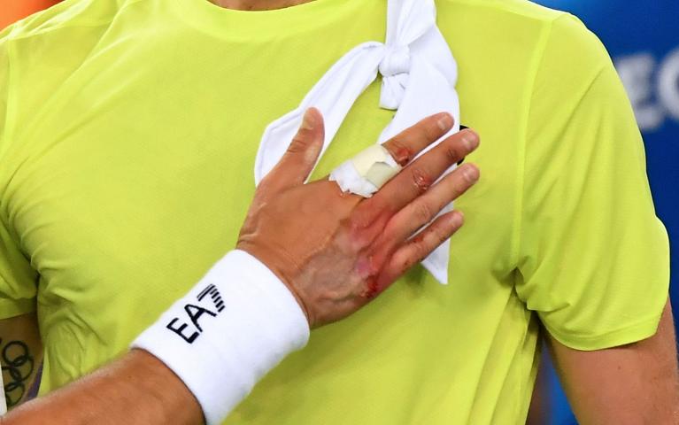 La mano destra di Fognini alla fine del match contro Thompson