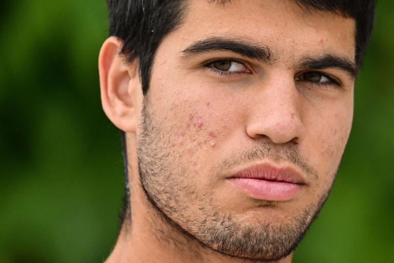 Carlos Alcaraz alla vigilia di Wimbledon 2023 (Getty Images)